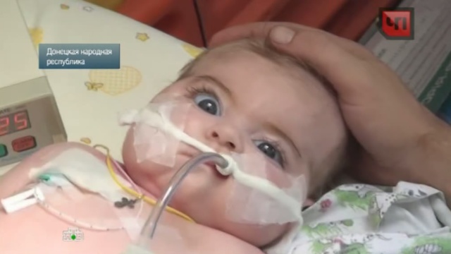 В ростовской больнице спасенному из Славянска младенцу стало лучше
